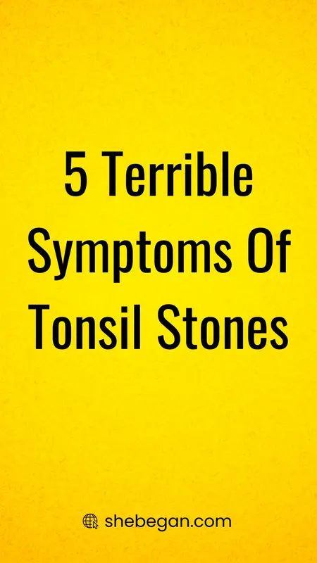 How to Make Tonsil Stones Go away Forever