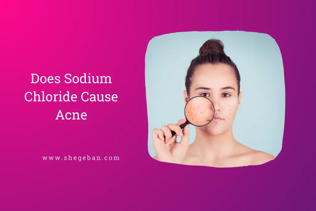 Does Sodium Chloride Cause Acne?