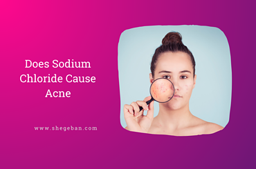Does Sodium Chloride Cause Acne?