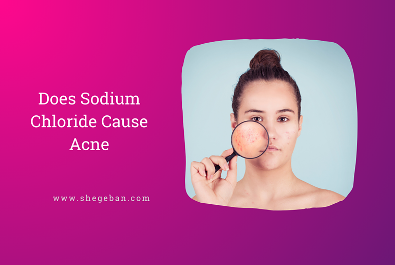 Does Sodium Chloride Cause Acne?
