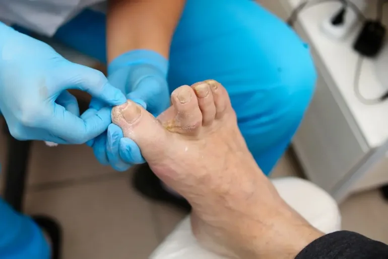 Why Is My Toenail Growing Sideways?
